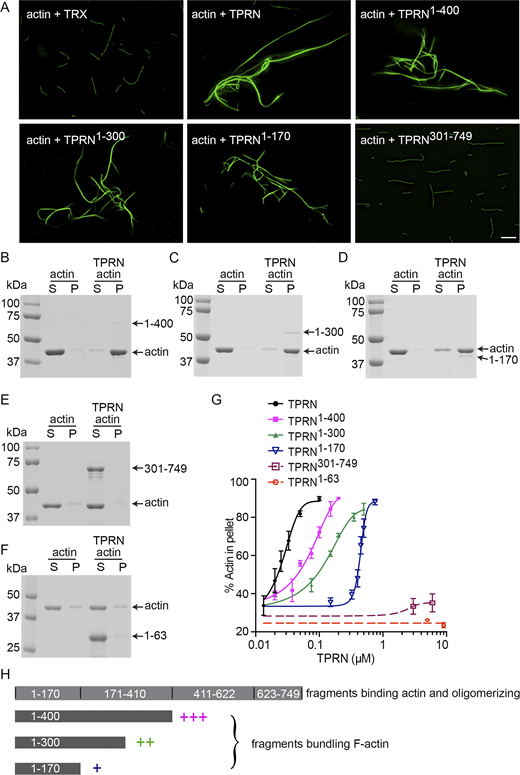 Characterization of actin-bundling ability of TPRN. All TPRN fragments and FL TPRN have a TRX tag at the N-terminus. (A) Actin filaments in the presence of a TRX tag, FL TPRN, or fragments of TPRN. Actin (3 μM) was incubated with 3 μM TRX, 0.1 μM FL TPRN, 0.15 μM TPRN1–400, 0.5 μM TPRN1–300, 0.75 μM TPRN1–170, or 1.5 μM TPRN301–749 at RT for 1.5 h, followed by labeling with fluorescent FITC-phalloidin. The experiment was performed more than three times, yielding consistent results. Scale bars: 5 μm. (B–F) Low-speed co-sedimentation assays were used to determine the cross-linking activity of TPRN fragments. Actin (3 μM) was incubated with buffer or 0.2 μM TPRN1–400 (B), 0.5 μM TPRN1–300 (C), 0.75 μM TPRN1–170 (D), 3 μM TPRN301–749 (E), or 9 μM TPRN1–63 (F) at RT for 1.5 h, followed by centrifugation. Equivalent amounts of supernatant (S) and pellet (P) were separated using SDS-PAGE and stained with Coomassie blue. Arrows with numbers on the right-hand side of each gel indicate corresponding TPRN fragment length in aa used in each experiment. All experiments were repeated at least three times. (G) Actin was incubated with varying amounts of FL TPRN or fragments of TPRN. Then, low-speed co-sedimentation assays were performed. The percentage of actin in the pellet was quantified (n ≥ 3). Data are represented as the mean ± SEM. (H) The TRX-TPRN schematics illustrating actin-bundling activities of various TPRN fragments indicated by a bracket based on co-sedimentation data showing that bundling relies on the N-terminal part of TPRN, while all TPRN fragments can bind actin and oligomerize. Source data are available for this figure: SourceData F5.