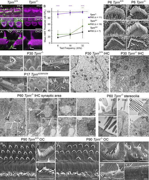 Tprn−/−mice are profoundly deaf at P60 and show abnormalities of IHCs and OHCs. (A–A″) Airyscan confocal images showing TPRN RabmAb immunoreactivity (green) and F-actin (magenta) in P20 WT (Tprn+/+) and TPRN null (Tprn−/−) mouse IHC (A) and OHC stereocilia (A′) and in P10 supporting cells surrounding IHCs and OHCs (A″). TPRN is localized at the base of Tprn+/+ stereocilia and associated with actin cytoskeleton of supporting Deiters’ cells but not detected in Tprn−/− hair cells and supporting cells. (A″) Enlarged side view of hair cell stereocilia showing TPRN localization at the base of OHC stereocilia in all three rows and co-localized with F-actin in ascending processes of Deiters’ cells. (B) Mean ABR thresholds at P60 of Tprn+/+, Tprn+/−, and Tprn−/− littermates at 8, 16, and 32 kHz. Using linear mixed effects regression, we found that Tprn−/− mice exhibited profound deafness at P60 at all frequencies (Tables S4 and S5), progressive deafness from P18 to P30 and P60 (Fig. S5 A; and Tables S2 and S3) and more pronounced early hearing loss at high frequencies (Fig. S5 A and Table S5). The graph displays mean ± SD. **, ***—significant difference in ABR threshold compared with Tprn+/+ animals at P < 0.01 and P < 0.001, respectively. Color of asterisks indicate the group showing the difference. (C–D″) Representative SEM images of IHC and OHC stereocilia bundles of P6 Tprn+/+ (C–C'') and P6 Tprn−/− mouse (D–D''). Note, a Tprn−/− IHC (D) has some stereocilia missing from the first row (arrow) and a less developed third row of stereocilia with more prominent pruning of thin stereocilia/microvilli as compared with a WT IHC stereocilia bundle (C). Tprn−/− OHC stereocilia bundle from apical turn (D′) also has a stereocilium missing from the first row and a shortened stereocilium in the second row (arrows), while all stereocilia in Tprn+/+ apical OHC (C′) are present and are of normal length. Tprn−/− OHC stereocilia bundle from the basal turn of the cochlea (D″) shows multiple missing stereocilia (arrows) from the third row and an altered V shape of the bundle, while the entire third row stereocilia are present in the WT V-shaped OHC from the basal turn (C″). (E and F) Stereocilia abnormalities in P30 Tprn−/− hair cells (E) are similar but less prominent than in P17 TprnN259/N259 hair cells (F). Shortening and disappearance of the third row stereocilia (E, left panel, forked arrow) and shortening of selective stereocilia from longer rows (E and F, left panels, arrows). Middle panels in E and F show OHCs with abnormal hair bundles. Right panels show fusion of IHC stereocilia (arrows). (G and H) TEM images of the synaptic area of a Tprn−/− IHC (H) show abnormal accumulation of endosome-like vesicular structures (arrow) when compared with a Tprn+/+ IHC (G). (I–Q) TEM micrographs of P60 Tprn−/− hair cells. (I) Accumulation of endosome-like vesicles in the cell cytoplasm (arrow) and presence of axosomatic efferent contacts with accumulation of vesicles at the postsynaptic sites (boxed area with an arrow). (J) Swollen and damaged IHC efferent presynaptic terminal. Boxed areas in I and J are enlarged in L–N, correspondingly. (K) Another example of swollen efferent terminal like in M. (O) IHC stereocilia show rootlet fragmentation and breakage at the stereocilia insertion point (top image), splayed rootlets within the cuticular plate, or multiple electron dense spots within stereocilia cores (bottom image). (P and Q) OHC stereocilia show long, prominent rootlets, sometimes penetrating abnormally deep into cytoplasm below the cuticular plate (P) and sometimes showing a hollow center of the rootlet structure (top image) and accumulation of the electron dense spots within the cell body nearby long splayed rootlets (bottom image) (Q). (R–Y) SEM images of P90 Tprn+/+ OC (R), showing three rows of OHC and one row of IHC from the middle turn of the cochlea with representative normal structure OHC hair bundle (S) and IHC hair bundle (T). (U) There are missing OHCs and fused IHC hair bundles in the middle turn of the P90 Tprn−/− OC. (V) Characteristic OHC hair bundle abnormalities with shortened stereocilia of all rows. (W) Common abnormalities of IHC stereocilia: fusion (arrow) and abnormally thin taper with some stereocilia absent likely as a result of breakage at the taper (two adjacent arrows). (X) OHCs from the upper basal turn also show stereocilia fusion (arrow). (Y) Lower basal turn shows complete absence of OHCs and only a few remaining IHCs, some with fused stereocilia bundles (arrow). Scale bars in A, A′, E, F, R, U, and Y are 5 μm, and in A″, G, and N are 2 μm. Scale bars in C–C″, D–D″, H, I, K–M, P, and Q are 1 μm, and in J and O are 500 nm.