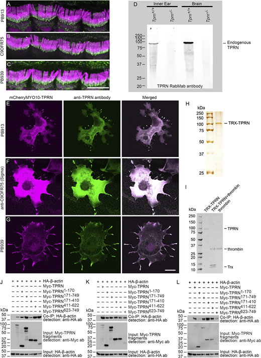 Validation of anti-TPRN antibodies used in the study. TRX-TPRN purity and instability without TRX tag and additional examples of Co-IP of TPRN and actin. (A) Custom-made rabbit polyclonal PB913 antibody against a peptide corresponding to aa residues 516–535 encoded by exon 1 of mouse Tprn shows localization of TPRN (green) at the base of hair cell stereocilia of adult mouse IHCs. (B) A commercial anti-C9ORF75 (TPRN) antibody (HPA020899, RRID:AB_1845835, aa 446–517, MilliporeSigma), shows localization of TPRN (green) similar to the custom-made PB913 antibody. (C) Custom-made C-terminal rabbit polyclonal antibody PB939 against a peptide corresponding to aa 726–749 of mouse TPRN also recognizes TPRN (green) at the base of stereocilia like the antibodies described above. Stereocilia bundles were visualized by counterstaining using rhodamine-phalloidin (shown in magenta). (D) Western blot from mouse brain and cochlear tissues using custom TPRN RabmAb against a C-terminal peptide identical to the antigen for PB939 antibody shows a specific band in Tprn+/+ tissues, but not in Tprn−/− tissues, indicating that the antibody specifically recognizes TPRN. (E–G) COS-7 cells transfected with mCherry-MYO10-TPRN construct are stained with three antibodies against TPRN, PB913 (E), anti-C9ORF75 (F), and PB939 (G). TPRN fused to mCherry-MYO10-HMM (magenta) was transported to the filopodia tips at the cell periphery and recognized there by anti-TPRN antibodies (green) used to immunostaining transfected cells. Co-localization of mCherry-MYO10-TPRN (magenta) with TPRN antibody immunoreactivity (green) results in white color, confirming that these three anti-TPRN antibodies can specifically recognize TPRN in different cellular compartments, including filopodia. Scale bar in A–C is 5 μm, in E–G is 20 μm. (H) Silver-stained acrylamide gel of purified TRX-TPRN shows a major band at about 100 kDa. (I) Coomassie blue–stained gel showing TRX-TPRN treated with thrombin protease to remove the TRX-tag. Lane 1—untreated purified TRX-TPRN, lane 2—TRX-TPRN treated with thrombin, and lane 3—thrombin alone. Note, there is no band of TPRN without TRX (∼80 kDa) present in the second lane, but both thrombin-specific band and the TRX band are present, indicating that the removal of the TRX tag resulted in an unstable TPRN protein. (J–L) Additional examples of Myc-TPRN and HA–β-actin Co-IP shown in Fig. 4 C. Note the variable amount of HA–β-actin in the Co-IP row for each experiment. Source data are available for this figure: SourceData FS1.