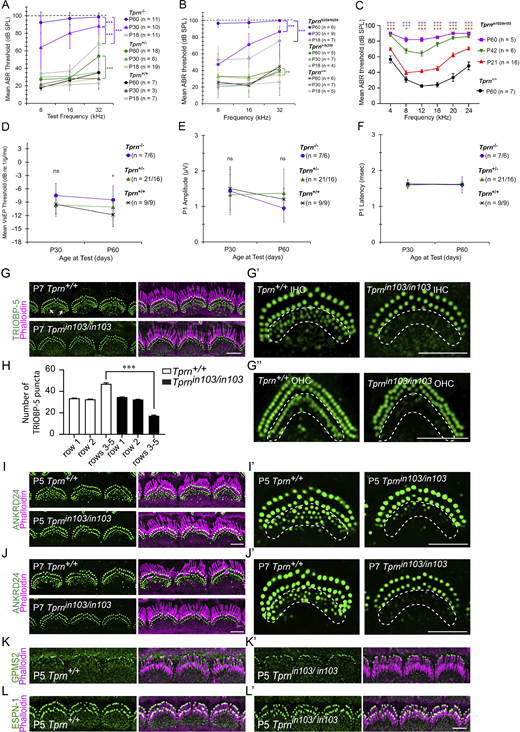 ABR thresholds of Tprn−/−, TprnN259/N259, and Tprnin103/in103mice and VsEP measurements of Tprn−/−mice. ANKRD24, TRIOBP-5, GPSM2, and ESPN-1 localization in WT and Tprnin103/in103postnatal hair cell stereocilia and hair bundle morphology of TPRN-deficient mice. (A) Mean ABR thresholds at P18, P30, and P60 of Tprn+/+, Tprn+/−, and Tprn−/− littermates at 8, 16, and 32 kHz. Using linear mixed effects regression, we found that Tprn−/− mice had significantly worse hearing overall (Table S2) and exhibited progressive deafness (Table S3) with greater early hearing loss at high frequencies (Tables S4 and S5). (B) Mean ABR thresholds of TprnN259/N259, Tprn+/N259, and Tprn+/+ littermate controls at P18, P30, and P60, n = number of animals tested. Similar to Tprn−/− mice, TprnN259/N259 mice exhibit worse hearing overall and a significant worsening of hearing over time (Tables S6 and S7). (C) Mean ABR thresholds of Tprnin103/in103 and WT control mice (Tprn+/+) at P21, P42, and 2 mo of age, n = number of animals tested. At all ages and frequencies, Tprnin103/in103 mice exhibited worse hearing than P60 Tprn+/+ (Tables S8 and S9). (D–F) Mean VsEP threshold (D), P1 amplitude (E), and P1 latency (F) for Tprn+/+, Tprn+/−, and Tprn−/− littermates at P30 and P60 time points. Tprn−/− mice did not exhibit significant differences in VsEP thresholds, P1 amplitudes, or P1 latencies except for a significant difference in VsEP threshold at P60 compared with Tprn+/+, P = 0.04 (Tables S10 and S11), which is likely attributable to expected test-retest variation between time points. N indicates the number of animals tested at P30/P60, correspondingly. Graphs A–F display mean ± SD. *, **, ***—significant difference compared with Tprn+/+ animals at P < 0.05, P < 0.01, and P < 0.001, respectively. Color of asterisks indicates the group exhibiting the difference. Brackets indicate differences within a genotype between time points. (G–G″) Whole mounts of cochlea from P7 WT and Tprnin103/in103 mice were stained with antibodies against TRIOBP-5 (G–G″) and phalloidin (magenta) to reveal stereocilia. (G′ and G″) Enlarged images of a representative IHC (G′) and OHC (G″) at stereocilia level. (H) Quantification of TRIOBP-5 puncta at the bases of different rows of OHC stereocilia of P7 Tprn+/+ and Tprnin103/in103 mice. Thirty-four WT and forty-two Tprn-deficient OHCs from at least three mice were analyzed per group. Data are means ± SEM. ***P < 0.001 by unpaired two-sided t test. (I–J′) Whole mounts of cochlea from P5 (I and I′) and P7 (J and J′) WT and Tprnin103/in103 mice were stained with antibodies against ANKRD24, and counterstained by phalloidin (magenta) to show F-actin of stereocilia. (I′ and J′) Enlarged images of a representative IHC at stereocilia level. Number of TRIOBP-5 and ANKRD24 puncta at bases of immature short-row stereocilia were significantly reduced in P5 and P7 Tprn-deficient hair cells. (K–L′) Cochlear whole mounts from P5 WT (K and L) and Tprnin103/in103 mice (K′ and L′) were stained for GPSM2 (K and K′) or ESPN-1 (L and L′), which is localized at tips of stereocilia. No significant change of GPSM2 or ESPN-1 localization was observed in Tprn-deficient mice (K′ and L′). Scale bars are 5 µm.