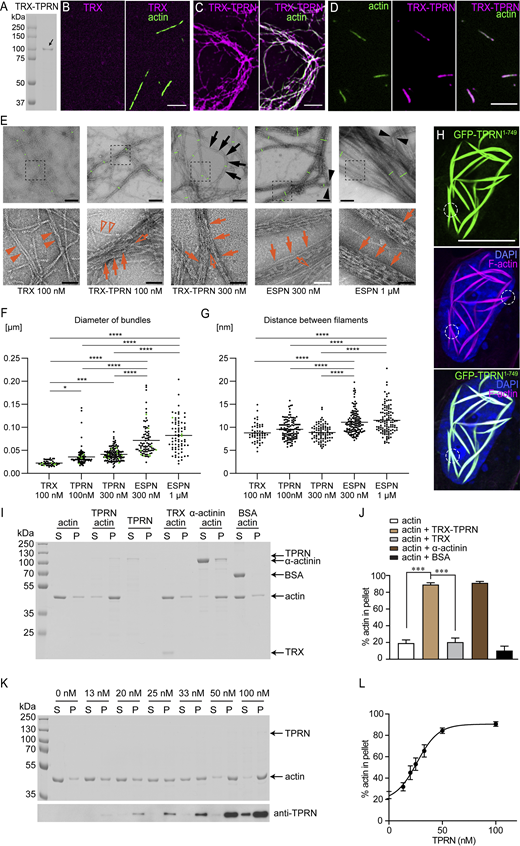 TPRN bundles F-actin filaments in vitro. (A) Coomassie blue-stained SDS-PAGE gel showing purified TPRN after expression in E. coli. A TRX tag was added to the N terminus in-frame with mouse TPRN, which improves its solubility and stability. The first lane is the protein ladder. The second lane is the purified TRX-TPRN protein (arrow), the size of which is ∼100 kDa. (B–D) Actin filaments (green) in the presence of control TRX tag only (B) or TRX-TPRN (magenta) (C and D). Actin (3 μM) was incubated with 0.1 μM TRX or TRX-TPRN at RT for 1.5 h. Using an antibody against TRX, the localization of TRX-TPRN (magenta) along F-actin filamentous structures (green) was visualized by fluorescence microscopy. Note, TRX tag alone (magenta) did not bind to F-actin filaments as shown in B. (D) TRX-TPRN (magenta) was distributed along the length of F-actin filamentous structures (green) and not concentrated just at the ends of F-actin. Scale bars in B–D: 5 μm. (E) Negative stain TEM images of F-actin polymerized with 100 nM TRX, 100 nM TRX-TPRN, 300 nM TRX-TPRN, 300 nM ESPN, or 1 µM ESPN. Images acquired at a low magnification (upper panels) and high magnification (lower panels). The short green lines across the bundles show the examples of bundle diameter measurements. ESPN is used at 300 nM or above since only a few bundles appear at 100 nM. TRX-TPRN bundles show bending (black arrows), while ESPN bundles occasionally appear kinked (black arrowheads). TRX-TPRN and ESPN bundle actin filaments (red arrows) with bifurcations (open arrows). Filaments bundled by 100 nM TRX-TPRN show single filaments branched from bundles (open red arrowheads). TRX samples occasionally show filaments neighboring one another (red arrowheads), which are analyzed as pseudo-bundles in F and G. Scale bars: 200 nm (E, upper panels) and 50 nm (E, lower panels). (F) Average diameter of F-actin bundles. Compared with the diameter of control 100 nM TRX (0.022 ± 0.005 µm, average ± SD, n = 46), the bundle diameter is significantly larger for 100 nM TRX-TPRN (0.035 ± 0.018, n = 102), 300 nM TRX-TPRN (0.041 ± 0.013 µm, n = 138), 300 nM ESPN (0.071 ± 0.034 µm, n = 87), and 1 µM ESPN (0.082 ± 0.035 µm, n = 73). One-way ANOVA shows P < 0.0001. Post hoc multiple comparisons by Tukey (****P < 0.0001; ***P = 0.0001; *P < 0.05; n.s.: P ≥ 0.05). (G) Average distances between filaments increasing in the order of TRX, TRX-TPRN, and ESPN. The concentration of TRX-TPRN and ESPN does not affect the distances between filaments. One-way ANOVA shows P < 0.0001 (8.7 ± 1.9 nm, n = 52 for 100 nM TRX; 9.5 ± 2.0 nm, n = 122 for 100 nM TRX-TPRN; 8.8 ± 1.7 nm, n = 86 for 300 nM TRX-TPRN; 11.1 ± 2.4 nm, n = 134 for 300 nM ESPN; 11.5 ± 3.0 nm, n = 111 for 1 µM ESPN). Post hoc multiple comparisons by Tukey (****P < 0.0001; n.s.: P ≥ 0.05). (H) Actin-bundling by EGFP-TPRN in COS-7 cell nucleus. EGFP-TPRN (green), phalloidin (magenta), DAPI (blue). Note the forked/conjoined areas of actin bundles outlined by circles resemble the bifurcated bundles of purified TRX-TPRN in D and E. Scale bars, 10 μm. (I) A low-speed (13,500 × g) co-sedimentation assay was used to determine the cross-linking activity of TPRN. Actin (3 μM) was incubated alone or with 0.1 μM TRX-TPRN or 6 μM TRX protein or 3 μM α-actinin or 3 μM BSA under polymerization conditions, followed by centrifugation. Equivalent amounts of supernatant (S) and pellet (P) were separated using SDS-PAGE and stained with Coomassie blue. The experiments were repeated at least three times. (J) Quantification of the percentage of actin in the pellet is shown in G. Data are represented as mean ± SEM. ***P < 0.001 by unpaired two-sided t test (n = 4). (K) Coomassie blue–stained protein gel showing 3 μM actin co-sedimented with TPRN of increased concentrations (13–100 nM). Immunoblotting detected TPRN in supernatant and pellet. (L) Percentage of actin in pellet is shown in I (n = 3). 100 nM TRX-TPRN was sufficient to saturate the binding sites of 3 μM F-actin. Data are represented as mean ± SEM. TPRN in I–L is tagged with TRX at its N terminus as indicated in A. Source data are available for this figure: SourceData F3.