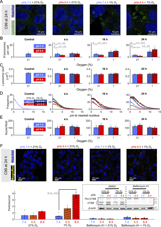 Acidotic hypoxia increases lysosomal abundance. CRC cells were incubated under normoxia (21% O2) or hypoxia (1% O2) in media at pH 6.4 or 7.4. (A and B) Treatment of C99 cells lasted up to 24 h and were followed by live-cell fluorescence imaging for Hoechst (nuclei) and LysoBrite Green (lysosomes) under normoxia and pHe 7.4. (A) Exemplar images at 24 h. (B and C) Quantification of LysoBrite–positive particles in terms of the number of lysosomes per cell (based on cell segmentation) and (C) lysosome size quantified as area. (D) Histogram of the distance from lysosome to its nearest nucleus, measured by applying a Euclidean distance transform to the binary image created from the segmented nuclear mask. Green dot indicates position at half-maximal abundance. (E) Quantification of the number of nuclei per field-of-view. (B, C, and E) Grey datapoints denote results from individual fields-of-view (three independent repeats). Black datapoints indicate mean of each independent repeat. (F) C99 cells were treated with normoxia or hypoxia in media at pH 6.4 or 7.4 for 24 h. Magic Red-(RR)2 was added at the start of incubations (1:260 dilution); Hoechst was added at the treatment end point, 30 min prior to imaging. Imaging sought evidence for fluorescence from the degradation product of Magic Red-(RR)2. Quantification from three independent repeats, each representing the average of 10–20 images per condition. Inset: pro-CTSB cleavage after the 24 h treatment. 20 nM bafilomycin-A1 was added to inhibit lysosome activity. Bars indicate mean + SEM. Statistical testing by (B) hierarchical two- or (F) three-way ANOVA with multiple comparisons (see Table S1 for full results). Source data are available for this figure: SourceData F9.