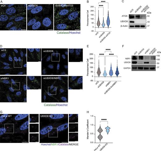 Depletion of ATG5 and overexpression of USP30 rescue pexophagy in UBXD8 KO cells. (A) Representative images of HeLa cells transfected with control, UBXD8, and ATG5 siRNAs and stained for catalase. (B) Quantification of peroxisomes per cell from A. 50–100 cells were analyzed in N = 3 independent experiments. The violin plot shows median and 95% confidence intervals. ****P < 0.0001, two-way ANOVA with Dunnett’s multiple comparisons test. (C) Immunoblot of UBXD8 and ATG5 depletion. (D) Representative images of HeLa cells transfected with control, UBXD8, or NBR1 siRNAs and stained for catalase. (E) Quantification of peroxisomes per cell from D. 50–100 cells were analyzed in N = 3 independent experiments. Violin plot shows median and 95% confidence intervals. ****P < 0.0001, two-way ANOVA with Dunnett’s multiple comparisons test. (F) Immunoblot of UBXD8 and NBR1 depletion. (G) WT and UBXD8 KO HeLa cells were stained with NBR1 and catalase. (H) Mander’s colocalization of images in G. 100–120 cells were analyzed in N = 3 independent experiments. The violin plot shows median and 95% confidence intervals. ****P < 0.0001, unpaired t test. The scale bar is 10 μM (A and D) and 5 μM (D and G). Source data are available for this figure: SourceData F8. Refer to the image caption for details.