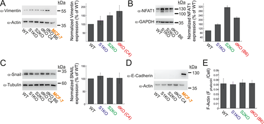 Expression of EMT markers and NFAT1 in MDA-MB-231 and MCF-7 cells. (A–D) Representative images (left) and quantitation (right) of WB analysis (n = 3–4) of lysates prepared from the indicated MDA-MB-231 or MCF-7 cells using antibodies for vimentin and actin (A), NFAT1 and GAPDH (B), Snail and tubulin (C), or E-cadherin and actin (D). (E) Quantification of total F-actin content in the indicated MDA-MB-231 cells (see Materials and methods). Bars show the mean ± SEM. Source data are available for this figure: SourceData FS2. Refer to the image caption for details.