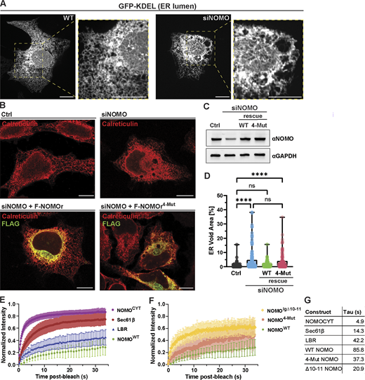 NOMO relies on the predicted Ig 1/10/11 interface for functionality. (A) Spinning disc confocal images of U2OS cells treated with either non-targeting (WT) or NOMO-targeting (siNOMO) RNAi. (B) Representative immunofluorescence images of U2OS cells treated with non-targeting siRNA (Ctrl) or NOMO-targeting siRNA (siNOMO), with indicated rescue constructs transfected in lower panels. (C) Immunoblot of cell lysates from experimental setups as in B. (D) Plot of mean ± SD of ER voids area normalized to total ER area determined by calreticulin staining under indicated conditions; n = 131 cells (Ctrl), n = 137 cells (siNOMO), n = 116 cells (siNOMO + F-NOMOr), and n = 115 cells (siNOMO + F-NOMOr4-Mut). (E and F) FRAP data showing means ± SD of fluorescence intensities of bleached regions normalized to the pre-bleach intensity for each condition. n ≥ 30 cells across a N ≥ 3 biological replicates. Note that NOMOWT data are the same in E and F. (G) Summary of mean tau (τ) values for each condition corresponding to FRAP experiments shown in E and F. Statistical analyses were performed using an ordinary one-way ANOVA test; ****P < 0.0001 and ns, not significant. Scale bars, 10 μm. Source numerical data and unprocessed blots are available in source data. Source data are available for this figure: SourceData F2.