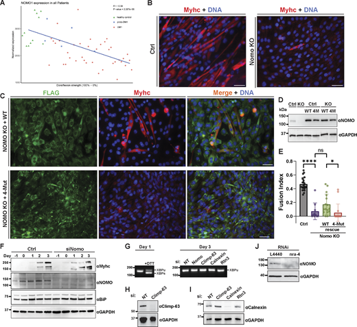 Normalized expression of NOMO1 intibialisanterior muscle biopsies and C2C12 differentiation in NOMO knockout cells. (A) Dorsiflexion strength was measured in control and DM1 patients against NOMO transcript levels (R = −0.59). proto-DM1, an intermediate form of DM1 corresponding to fewer CTG repeats (50–100) than DM1 (>100) or healthy controls (<30). (B) Myogenesis was performed as in Fig. 6 A and immunostained for Myhc and stained for DNA with DAPI. (C) Immunoblot of control or NOMO-depleted (siNomo) myoblasts during indicated days of differentiation. (D) Assay performed as in B, with myoblasts stably expressing either WT (F-NOMOWT) or 4-Mut (F-NOMO4-Mut) constructs in Nomo knockout lines. (E) Quantification of myogenesis under indicated conditions, scored by fusion index. n = 21 frames, 2,433 nuclei (Ctrl), n = 10 frames, 1,411 nuclei (Nomo KO), n = 16 frames, 1,207 nuclei (Nomo KO, WT rescue), and n = 16 frames, 1,717 nuclei (Nomo KO, 4-Mut rescue). (F) Immunoblot comparing protein levels in control (Ctrl) and Nomo knockdown (siNomo) conditions during differentiation. Samples were collected at multiple time points up to day 3 of differentiation. Immunoblot analysis of myogenic markers in control and siNomo-treated cells over 4 days. (G) cDNA obtained from the indicated treated myotubes during day 1 or day 3 of differentiation, amplified via PCR using XBP-1–specific primers, separated by agarose, and stained with SYBR Safe. (H and I) Immunoblot of siRNA knockdown efficiency for Climp-63 and calnexin. GAPDH serves as a loading control. (J) Immunoblot analysis of nra-4 in Ctrl (L4440) and knockdown conditions and probed with anti-NOMO antibody. Statistical analyses were performed using an ordinary one-way ANOVA test; ****P < 0.0001, *P < 0.05, and ns, not significant. Error bars show min. to max. point range. All scale bars, 50 μm. Source numerical data and unprocessed blots are available in source data. Source data are available for this figure: SourceData FS4. Refer to the image caption for details.