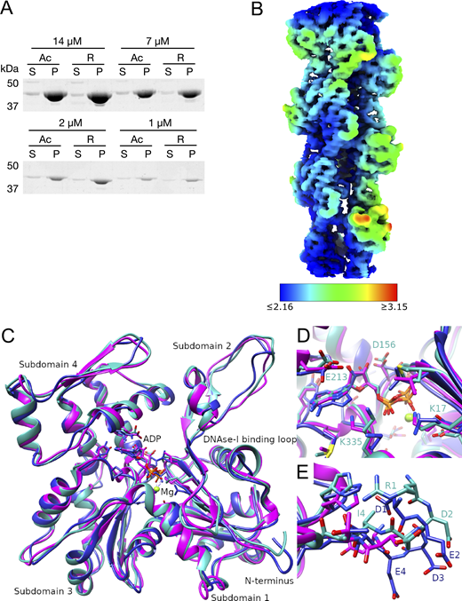 The local resolution map of R-β-actin and comparison of the R-β-actin, chicken, and rabbit skeletal muscle actin structures. (A) The purified Ac- and R-actin were polymerized in vitro and ultracentrifuged at 100,000 × g for 1 h. The proteins in the supernatant (S) and pellet (P) were assessed by SDS-PAGE and Coomassie staining. (B) The local resolution map of R-β-actin color coded as per the legend. (C) Ribbon diagram comparing the structure of R-β-actin presented here (cyan) with previously published structures of chicken (navy) and rabbit (magenta) skeletal muscle actin. (D) Close-up view comparing the structure of the active site of R-β-actin with previously published structures of chicken and rabbit skeletal muscle actin. (E) Close up view comparing the N-terminal sections of R-β-actin to that of chicken and rabbit skeletal muscle actin. Source data are available for this figure: SourceData FS1.