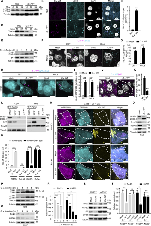 C. violaceum infection induces mitophagy in vivo and in vitro. (A) Immunoblot analysis of LC3B lipidation (LC3B-II) in the livers of C57BL/6N mice (n = 3) intraperitoneally injected with PBS or 12 × 106 CFU C. violaceum WT strain for 10 h. Liver homogenates were immunoblotted with anti-LC3B antibody. C.v. WT, C. violaceum WT strain. The abbreviations and symbols used in this article have consistent meanings throughout. (B) Immunofluorescence analysis of LC3B puncta in the livers of C57BL/6N mice (n = 3). Mice were intraperitoneally injected with PBS or C.v. WT-expressing RFP (magenta) at 12 × 106 CFU for 10 h. Livers were subjected to immunofluorescence by anti-LC3B (cyan). Nuclei (gray) were stained with DAPI. Scale bar, 10 µm. (C) Quantification of LC3B puncta as shown in B. Mean ± SEM, n = 35 cells in each group. (D) The level of Tom20 in the livers of C57BL/6N mice (n = 2) treated as in A. Livers were homogenized and lysed. The level of Tom20 was analyzed by immunoblotting with anti-Tom20 antibody. (E) Immunoblotting of LC3B-II and p62 in 293T cells infected with C.v. WT at a MOI of 5 for indicated time points. (F and G) Immunofluorescence of LC3B puncta in 293T cells or HeLa cells. 293T cells were infected with C.v. WT-expressing RFP (magenta) at a MOI of 5 for 3 h. HeLa cells were infected with C.v. WT-expressing RFP (magenta) at a MOI of 10 for 4 h. LC3B (cyan) was stained with anti-LC3B antibody. Nuclei (gray) were stained with DAPI. Scale bar, 10 µm. Quantification of LC3B puncta in mock and C.v. WT-infected cells (G). Data are shown as mean ± SEM (n = 25 cells in each group). (H and I) Immunofluorescence of GFP-LC3B puncta in 293T cells stably expressing GFP-LC3B or HeLa cells stably expressing GFP-LC3B. 293T cells stably expressing GFP-LC3B (cyan) were assayed at a MOI of 5 for 3 h. HeLa cells stably expressing GFP-LC3B (cyan) were infected with C.v. WT at a MOI of 10 for 4 h. C. violaceum (magenta) was labeled with anti–C. violaceum antibody. Scale bar, 10 µm. Quantification of GFP-LC3B puncta in mock and C.v. WT-infected cells (I). Data are shown as mean ± SEM (n = 25 cells in each group). (J and K) Immunofluorescence of p62 in HeLa GSDMD−/− cells. Cells were infected with C.v. WT-expressing GFP (cyan) at a MOI of 10 for 5 h. Then p62 (magenta) were stained with anti-p62 antibody. The white dashed line in the figure shows the outline of the cell. Unless otherwise specified, the white dashed lines used in this article have consistent meanings throughout. Scale bar, 10 µm. Quantification of p62 puncta (K). Data are shown as mean ± SEM (n = 35 cells in each group). (L)C.v. WT infection induces mitochondrial localization of LC3B-II. 293T cells were infected with C.v. WT (MOI = 5) for 2 h. As a positive control, Parkin-transfected 293T cells were treated with DMSO or CCCP (10 µM, 2 h). Subcellular fractionation was performed to isolate cytosolic (Cyto) and mitochondrial (Mito) fractions, followed by immunoblotting analysis of LC3B-II. Tubulin and Tom20 served as markers for cytosolic and mitochondrial fractions, respectively. (M and N)C. v. WT infection promotes the fusion of mitophagosome with lysosome. 293T cells were transfected with pmRFP-GFP-Mito for 12 h. Then cells were infected with C.v. WT (MOI = 5) for 5 h in the presence of DMSO or 50 nM bafilomycin A1 and analyzed by immunofluorescence. Scale bar, 10 µm. mRFP-Mito was labeled with magenta. mRFP-Mito was labeled with cyan. C. violaceum (yellow) was labeled with anti–C. violaceum antibody. Quantification of mRFP and mRFP+GFP+ puncta (N). Mean ± SEM, n = 40 cells in each group. P values were determined by two-way ANOVA. (O)C. violaceum infection triggers mitophagy in KCs. Primary KCs were infected with C.v. WT (MOI = 2, 3 h). Whole-cell lysates were subjected to immunoblotting using antibodies against LC3B, p62, and mitochondrial markers (Tom20/HSP60). (P) Immunoblots showing Tom20 and LC3B-II levels in 293T cells treated as in E. (Q and R) Immunoblotting showing levels of Tim23 and HSP60 in 293T cells infected with C.v. WT (MOI = 5) for indicated time. Cells were lysed and immunoblotted with indicated antibodies (Q). Quantification of normalized Tim23 and HSP60 (R). Data are represented as mean ± SEM (n = 3, three independent experiments). P values were determined by one-way ANOVA with Dunnett’s test. (S and T)ATG5 deficiency blocks mitophagy. WT and ATG5−/− MEF cells were infected with C.v. WT (MOI = 5) for 4 h and subsequently subjected to immunoblot using the indicated antibody (S). Quantification of normalized Tim23 and HSP60 (T). Data are represented as mean ± SEM (n = 3, three independent experiments, two-way ANOVA) All data are representative of three independent experiments. Unpaired two-sided Student’s t tests were used to measure significance (C, G, I, and K). ns, not significant; *P < 0.05; **P < 0.01; ***P < 0.001; ****P < 0.0001. Source data are available for this figure: SourceData F1. Refer to the image caption for details.