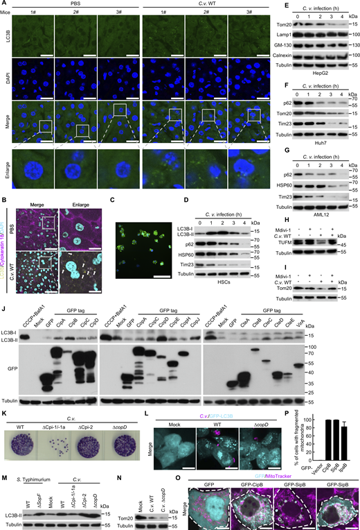 C. violaceum infection induces mitophagy independently of CopD. (A) Confocal microscopy analysis of LC3B puncta in the livers of mice (n = 3) intraperitoneally injected with PBS or 12 × 106 CFU C. violaceum WT strain (C.v. WT for 10 h). Livers were subjected to immunofluorescence by anti-LC3B (green). Nuclei (blue) were stained with DAPI. Scale bar, 20 µm; inserts, 5 µm. (B) Confocal microscopy analysis of LC3B puncta in hepatocytes of mice (n = 3) treated as in A. Hepatocytes were labeled with anti-cytokeratin 18 antibody (magenta), and LC3B (yellow) was stained with anti-LC3B antibody. Nuclei (cyan) were counterstained with DAPI. Scale bar, 40 µm; inserts, 10 µm. (C) Immunofluorescence analysis of KCs isolated from mouse livers. Freshly isolated KCs were plated for 2 h, followed by PBS washing to remove debris and non-adherent cells. Cells were stained with the macrophage marker F4/80 (green). Nuclei (blue) were counterstained with DAPI. Scale bar: 40 µm. (D–G)C. violaceum infection induces mitophagy in HSCs (D), HepG2 cells (E), Huh7 cells (F), and AML12 cells (G). Cells were infected with C.v. WT (MOI = 5) for indicated times, followed by western blot analysis of cell lysates using the specified antibodies. (H and I) Immunoblotting analysis of TUFM (H)/Tom20 (I) in 293T cells infected with C.v. WT and treated with or without Mdivi-1 (20 μM) for 5 h. (J) LC3B levels were assessed by immunoblotting in 293T cells transfected with a vector control or Cpi-1/-1a T3SS effectors. (K) The invasion ability of different C. violaceum strains was evaluated using gentamicin protection assays in HeLa GSDMD−/− cells. C.v. ΔcopD: C. violaceum mutant strain with deletion of the copD gene. (L–N)C.v. ΔcopD infection induces mitophagy. (L) 293T cells expressing GFP-LC3B (cyan) were infected with WT or C.v. ΔcopD and analyzed by fluorescence microscopy. C. violaceum (magenta) was labeled with anti–C. violaceum antibody. Scale bar: 10 µm. (M and N) Cell lysates from infected cells were immunoblotted with anti-LC3B (M) or anti-Tom20 (N). (O and P) Confocal microscopy analysis of mitochondrial morphology in HeLa cells transfected with GFP, GFP-CipB, GFP-SipB, or GFP-IpaB (cyan), respectively. (O) Mitochondria were stained with a ΔΨm-dependent MitoTracker (pseudo-colored magenta). Scale bar, 10 µm. (P) Quantifications of the percentages of cells showing fragmented mitochondria among 100 randomly selected transfection-positive cells. P values were determined by one-way ANOVA with Dunnett’s test. All data are representative of three independent experiments. Source data are available for this figure: SourceData FS1. Refer to the image caption for details.