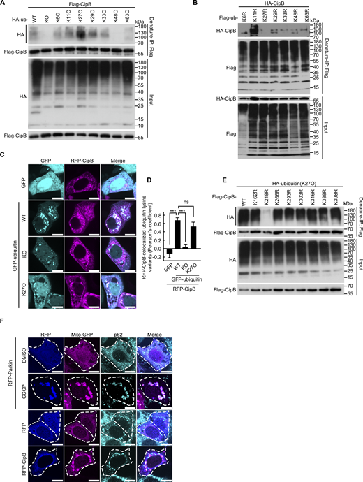 CipB is primarily ubiquitinated at lysine 218 (K218) through K27-linked polyubiquitin chains. (A) Denature-IP showing the binding of Flag-CipB to HA-tagged ubiquitin variants in 293T cells. Cells were lysed and subjected to denature-IP. The immunoprecipitate was eluted with FLAG peptide and analyzed by immunoblotting. (B) Denature-IP analysis of HA-CipB and Flag-tagged ubiquitin variants. Cells were lysed and subjected to denature-IP. The immunoprecipitate was eluted with SDS loading buffer and analyzed by immunoblotting. (C) Confocal microscopy analysis of the colocalization between RFP-CipB (magenta) and GFP-ubiquitin lysine variants (cyan). Scale bar, 10 μm. (D) Quantification of Pearson’s colocalization coefficient between RFP-CipB and ubiquitin lysine variants. Mean ± SEM, n = 25 cells in each group. P values were determined by one-way ANOVA with Tukey’s test. ns, not significant; ***P < 0.01. (E) Denature-IP showing the binding of HA-ubiquitin (K27O) to Flag-CipB mutations in 293T cells. Cells were lysed and subjected to denature-IP. The immunoprecipitate was eluted with FLAG peptide and analyzed by immunoblotting. (F) CipB induces p62 recruitment to mitochondria in HeLa cells. Cells were co-transfected with Mito-GFP (magenta) and RFP-tagged (blue) plasmids for 14 h, followed by immunostaining for endogenous p62 (cyan). Positive control: cells co-transfected with RFP-Parkin (blue) and Mito-GFP were treated with 10 μM CCCP for 6 h to induce p62-mitochondria colocalization. Scale bar: 10 μm. All data are representative of three independent experiments. Source data are available for this figure: SourceData FS3. IP, immunoprecipitation. Refer to the image caption for details.