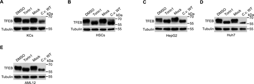 C. violaceum infection activates TFEB. (A–E) Immunoblot analysis demonstrating TFEB activation following 4-h infection with WT C. violaceum (C.v. WT) in (A) KCs (MOI = 2), (B) HSCs (MOI = 5), (C) HepG2 cells (MOI = 5), (D) Huh7 cells (MOI = 5), and (E) AML12 cells (MOI = 5). Positive controls: cells were treated with DMSO or Torin1 (330 nM) for 4 h. All lysates were analyzed by immunoblotting with anti-TFEB antibody. Source data are available for this figure: SourceData FS4. Refer to the image caption for details.