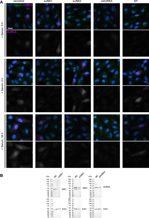Analysis of AURKA accumulation at centrosomes and evaluation of gene knockdown efficiency. (A) Representative images used for the analysis of AURKA accumulation at centrosomes, related to Fig. 4 A. Scale bar, 20 µm. (B) Western blot analysis to evaluate gene knockdown efficiency. Relative to the negative control (set as 100%), protein expression levels were reduced to 16.6% (siJNK1), 41.5% (siJNK2), and 38.6% (siAURKA), respectively. Source data are available for this figure: SourceData FS5. Refer to the image caption for details.