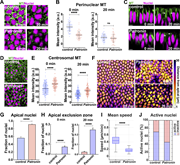 Compromising Patronin function disrupts ncMT pools and severely impedes nuclear dispersion. (A) Still frames showing MT depletion and detachment from nuclei in Patronin shRNA (Patronin) embryos compared to control. (B) Quantitation highlighting the depletion of perinuclear MT intensities in Patronin embryos compared to control at GBE onset; n = 60 perinuclear regions for each background at 0 min and n = 61 and 59 perinuclear regions for control and Patronin measurements, respectively, at 20 min, k = 3 embryos each. (C) Apical–basal view of MTs and nuclei in control (top) and Patronin (bottom) embryos at 0 and 20 min, showing decreased apical MT networks after Patronin disruption. Arrows point to apical MT. (D) Still frame showing MT enrichment at centrosomal regions in Patronin embryos as compared to control embryos. (E) MT intensities at centrosomes in control and Patronin embryos at 0 and 20 min, indicating enhanced centrosomal MT at both time points; n = 200 and 150 centrosomal regions for control and Patronin, respectively, at 0 min, and n = 200 and 149 centrosomal regions for control and Patronin, respectively, at 20 min, k = 3 embryos for each background. (F) Maximum-intensity projections of nuclei with color-codes based on distance from cell apices in control and Patronin embryos at onset and 20 min into GBE. (G) Comparison of the fraction of nuclei present in the apical 10 μm of cells in control and Patronin embryos indicating inhibited nuclear dispersion on disruption of ncMT; n = 263 and 605 nuclei from k = 3 embryos for control and Patronin, respectively. (H) Fraction of nuclei present in the apical-most 2 μm of the cell (apical exclusion zone) in control and Patronin embryos; n = 455 and 833 nuclei in control and Patronin, respectively at 0 min and n = 483 and 605 nuclei in control and Patronin, respectively, at 20 min, k = 3 embryos for each background. (I) Mean nuclear speed in control and Patronin embryos. (J) Percent of active nuclei as detected by the mean squared displacement (MSD) metric. (I and J)n = 546 and 291 measured nuclei for control and Patronin, respectively, k = 3 embryos each background. Scale bar = 10 μm for (F), 5 μm for (A, C, and D). Fig. 2, A, C, D, and F; Fig. 5 E; Fig. 3, C, D, and F; Fig. 5 H; and Fig. 7 C, control images/plots reproduced for comparison purposes. All scatter plots show the mean ± SD. Statistical significance was calculated using the Mann–Whitney U-test. ns, not significant. ****P < 0.0001.