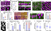 Disrupting CLASP function compromises formation of ncMT perinuclear baskets and nuclear orientation and dispersion. (A) Still frames comparing perinuclear MTs in control and CLASP shRNA (CLASP) embryos reveal depleted MTs and detachment from nuclei. (B) Scatter plot of perinuclear MT intensities at GBE onset after CLASP disruption; n = 60 and 42 perinuclear regions for control and CLASP, respectively, k = 3 embryos each background. (C) Orthogonal projection showing depleted MTs (green) in CLASP embryos and defective nuclear positioning as compared to control. Arrows mark apical MTs and arrowheads mark centrosomal MTs, respectively. (D) Still frames showing enhanced centrosomal MTs and depleted perinuclear MTs in CLASP embryos compared to control. (E) Quantitation reveals enhanced MT intensities at centrosomes in CLASP as compared to control at 0 and 20 min GBE; n = 200 centrosomal regions for each background, k = 3 control embryos and k = 4 CLASP embryos. (F) Maximum-intensity projection of nuclei color-coded for position from cell apices in control and CLASP embryos. (G) Orthogonal projection of cells and nuclei in control and CLASP embryos showing apically collapsed and deformed nuclei in CLASP embryos. (H) Fraction of nuclei in apical 10 μm of cell showing nuclear crowding in apical regions in CLASP embryos; n = 236 and 258 for control and CLASP, respectively, from k = 3 embryos. (I) Still image of nucleus displaying misaligned groove after CLASP disruption. (J) Fraction of nuclei invading the apical exclusion zone in control and CLASP embryos; n = 455 and 340 nuclei for control and CLASP, respectively, at 0 min and n = 483 and 378 nuclei for control and CLASP, respectively, at 20 min, k = 3 embryos each. (K) Percent of active nuclei as detected by MSD in control and CLASP embryos. (L) Peak nuclear speeds in control and CLASP embryos. (M) Mean nuclear speeds in control and CLASP embryos. (J–L), n = 546 and 427 measured nuclei in control and CLASP, respectively, k = 3 embryos for each background. (M) Scale bar = 5 μm in A, C, D, G, I, and 10 μm in F. Fig. 3, A, C, and D; Fig. 7, A and C; Fig. 2, C and D; and Fig. 5 H reproduced for comparison purposes. All scatter plots show the mean ± SD. Statistical significance was calculated using the Mann–Whitney U-test. ****P < 0.0001.