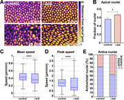 Nuclear behaviors after γ-tub disruption. (A) Nuclei color-coded for apical–basal position in control and γ-tub embryos. (B) Fraction of nuclei in apical 10 μm of cell in control and γ-tubulin embryos; n = 263 and 273 nuclei for control and γ-tub, respectively, k = 3 embryos each background. (C) Mean nuclear speeds in control and γ-tub embryos. (D) Peak nuclear speeds in control and γ-tub embryos; n = 546 and 612 in control and γ-tub, respectively, from k = 3 embryos for each background. (E) Percent of active nuclei as detected by MSD in control and γ-tub embryos. (C and E) n = 546 and 1,223 nuclei in control and γ-tub, respectively, from k = 3 embryos for each background. Scale bar = 10 μm. Statistical significance was calculated using the Mann–Whitney U-test. *P < 0.05, ****P < 0.0001.