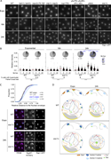 A multi-panel image showing telomere clustering in various yeast strains.