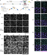 A multi-panel panel showing the effects of Esc1 mutation on telomere anchoring and protein localization.
