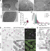 A multi-panel image to study the role of Vid27 in nuclear envelope sealing.