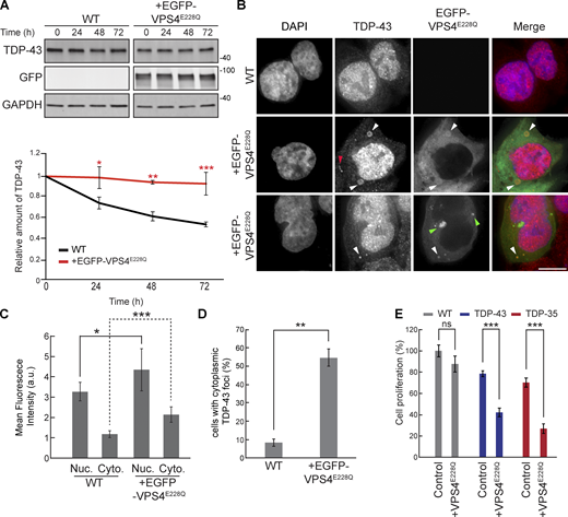 VPS4AE228Qincreases TDP-43 stability and promotes cytoplasmic mislocalization. (A) HEK293A WT cells were transfected with EGFP-VPS4AE228Q plasmid (pRB475) or mock transfected and grown in normal conditions for 48 h. Cells were then treated with 0.3 mg/ml cycloheximide for the indicated amounts of time, and TDP-43 levels were detected by western blot with anti–TDP-43 antibodies and normalized to the level of the GAPDH loading control. *, P < 0.05; **, P < 0.01; ***, P < 0.001 by one-way analysis of variance with Tukey’s post hoc test; N = 3. (B) HEK293A WT cells were either mock transfected (top row) or transfected with EGFP-VPS4AE228Q plasmid (next two rows, to show phenotypic diversity) and grown in normal conditions for 48 h before being fixed and immunostained with anti–TDP-43 antibodies. White arrowheads indicate TDP-43 and EGFP-VPS4AE288Q colocalization; red arrowhead indicates example of TDP-43-distinct foci; green arrowheads indicate examples of distinct EGFP-VPS4AE288Q foci/vesicular structures. N = 3; scale bar, 10 µm. (C) Quantification of mean nuclear and cytoplasmic TDP-43 signal intensities in HEK293A WT cells and cells transfected with EGFP-VPS4AE228Q plasmid. *, P < 0.05; ***, P < 0.001 by Mann–Whitney U test (nuclear) or Welch’s two-tailed T test (cytoplasmic); N = 30. (D) Quantification of the percentage of cells with cytoplasmic TDP-43 foci in HEK293A WT cells and cells transfected with EGFP-VPS4AE228Q plasmid. **, P < 0.01 by Welch’s two-tailed T test; N = 3. (E) HEK293A, HEK-TDP-43-GFP, and HEK-TDP-35-GFP cells were seeded at equal cell numbers and transfected with VPS4AE228Q plasmid or mock transfected, and cell proliferation was compared after 48 h ***, P < 0.001 by one-way analysis of variance with Tukey’s post hoc test; N = 3. Error bars in all graphical panels represent standard error of the mean. Source data are available for this figure: SourceData F4. Refer to the image caption for details.