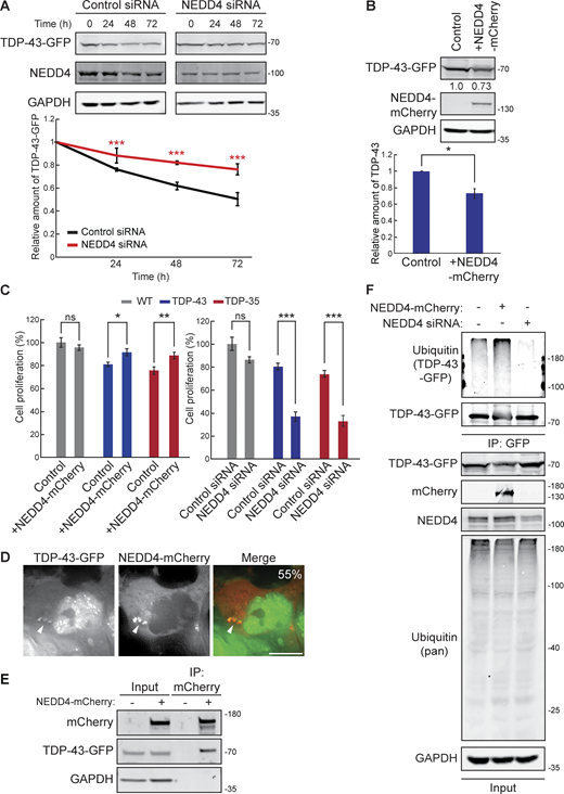 NEDD4 regulates TDP-43 turnover, toxicity, and ubiquitination. (A) HEK-TDP-43-GFP cells were transfected with siRNAs targeting NEDD4 or noncoding control and grown in normal conditions for 3 days. Cells were then treated with 0.3 mg/ml cycloheximide for the indicated amounts of time, and TDP-43-GFP levels were detected by western blot with anti-GFP antibodies and normalized to the level of the GAPDH loading control. ***, P < 0.001 by two-way analysis of variance with Tukey’s post hoc test; N = 3. (B) HEK-TDP-43-GFP cells were transfected with NEDD4-mCherry plasmid (pRB334) and grown in normal conditions for 3 days. TDP-43-GFP levels were detected by western blot with anti-GFP antibodies and normalized to the level of the GAPDH loading control. *, P < 0.05 by Welch’s two-tailed T test; N = 3. (C) HEK293A, HEK-TDP-43-GFP, and HEK-TDP-35-GFP cells were seeded at equal cell numbers and transfected with NEDD4-mCherry, a mock transfection control (left), or siRNA targeting NEDD4 or noncoding control (right), and cell proliferation was compared after 48 h *, P < 0.05; **, P < 0.01; ***, P < 0.001 by one-way analysis of variance with Tukey’s post hoc test; N = 3. (D) HEK-TDP-43-GFP cells were transfected with NEDD4-mCherry plasmid and incubated for 24 h before being imaged. Percentage value indicates colocalization frequency of cytoplasmic TDP-43-GFP foci with NEDD4-mCherry foci. N = 3; scale bar, 10 µm. (E) HEK-TDP-43-GFP cells were transfected with NEDD4-mCherry plasmid or a mock transfection and incubated for 48 h before mCherry was immunoprecipitated, and TDP-43-GFP binding was assessed via western blot using anti–TDP-43 antibodies. (F) HEK-TDP-43-GFP cells were transfected with siRNAs targeting NEDD4, NEDD4-mCherry plasmid, or a mock control and grown for 3 days before TDP-43-GFP was immunoprecipitated under denaturing conditions (See Materials and methods). Error bars in all graphical panels represent standard error of the mean. Source data are available for this figure: SourceData F5.