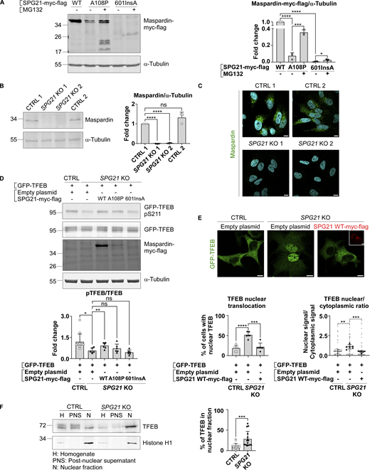 Pathogenic mutations in SPG21 cause maspardin misfolding, and maspardin deficiency decreases pTFEB/TFEB ratio in HeLa cells. (A) HeLa cells were transfected for 48 h with either SPG21 WT-myc-flag, SPG21 A108P-myc-flag, or SPG21 601insA-myc-flag constructs and treated with DMSO (vehicle) or 1 µM of MG132 during the last 16 h. Maspardin was detected by western blotting using an anti-myc antibody (at ∼38 kDa for the WT and p.A108P mutants and at ∼28 kDa for the c.601insA mutant). α-Tubulin detection was used as a loading control. Fold changes of maspardin/α-tubulin signal are shown in the graph on the right. Mean ± SD. n = 3 independent experiments. Two-tailed unpaired t test. *P < 0.05; ***P < 0.001; ****P < 0.0001. (B) Western blotting detection of endogenous maspardin in two control (CTRL) and two newly-generated SPG21 KO HeLa clones. The graph shows fold changes of maspardin/α-tubulin signal. Mean ± SD. n = 3 independent experiments, including two CTRL and two KO clones (open circles: CTRL1; open squares: CTRL2; black triangles: KO1; black diamonds: KO2). Two-tailed unpaired t test. ns, nonsignificant; ****P < 0.0001. (C) Immunofluorescence detection of endogenous maspardin (green) in CTRL and SPG21 KO clones. Nuclei were stained with DAPI. One representative set of n = 3 independent experiments, including two CTRL and two KO clones. Scale bar = 10 µm. (D) Western blotting analysis and quantification of the pTFEB(Ser211)/TFEB ratio in CTRL and SPG21 KO HeLa cells 48 h after transfection of a GFP-TFEB construct with an empty plasmid or a SPG21-myc-flag construct (WT, p.A108P, or c.601insA). Overexpressed proteins were detected with an anti-myc antibody (N.B. due to its extensive degradation, the 601insA mutant is not detected under these basal conditions). n = 6 for the KO cells (3 independent experiments, including two different KO clones) and n = 12 for the CTRL cells (each of the 6 blots contained the two CTRL clones co-transfected with GFP-TFEB and an empty plasmid. Only one is shown in the figure). Mean fold change of pTFEB/TFEB ratio ± SD. Two-tailed unpaired t test. *P < 0.05; **P < 0.01. (E) Analysis of GFP-TFEB distribution in CTRL and SPG21 KO HeLa by confocal microscopy 72 h after transfection with an empty vector or SPG21 WT-myc-flag. Scale bar = 10 µm. The graphs show the mean percentage of cells (± SD) with a predominant nuclear localization for TFEB (left) or TFEB nuclear/cytoplasmic signal ratio (right). n = 6 (three independent experiments, including each two different CTRL and two different KO clones). 10 cells were analyzed per clone in each experiment. These values are shown in light gray, while their averages are shown as follows: open circles: CTRL1; open squares: CTRL2; black triangles: KO1; black diamonds: KO2. Two-tailed unpaired t test. **P < 0.01; ***P < 0.001; ****P < 0.0001. (F) Analysis of endogenous TFEB nuclear/cytoplasmic distribution in CTRL or SPG21 KO HeLa cells. The cells were homogenized and fractionated into a nuclear (N) fraction and a postnuclear supernatant (PNS) fraction. Equal amount of proteins from the cell homogenates (H), N, and PNS fractions were analyzed by western blotting using an anti-TFEB antibody. Histone H1 (nuclear marker) was used as a control. n = 16 (8 independent experiments, including two CTRL and two KO clones). The graph shows the mean percentage of TFEB in the N fraction relative to total cellular signal ± SD. Two-tailed paired t test. ***P < 0.001. Source data are available for this figure: SourceData F1. Refer to the image caption for details.
