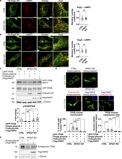 Activation of RagC by transfection of its GAP FLCN-FNIP2 rescues TFEB phosphorylation and localization. (A) Colocalization analysis between HA-RagC (green) and LAMP2 (red) 24 h after transfection in CTRL and SPG21 KO HeLa cells. Scale bar = 10 µm. n = 6 (three independent experiments, including two clones per genotype). 10 cells were analyzed per clone in each experiment. These values are shown in light gray. Their averages are shown as follows: open circles: CTRL1; open squares: CTRL2; black triangles: KO1; black diamonds: KO2. Mean Manders’ coefficients ± SD. Two-tailed unpaired t test. ns, nonsignificant. (B) Colocalization analysis between HA-RagA and LAMP2 in CTRL and SPG21 KO HeLa cells as described in A. (C) Western blotting analysis of pTFEB/TFEB ratio in CTRL and SPG21 KO HeLa cells 48 h after transfection of GFP-TFEB with either an empty plasmid, a folliculin-His and/or a Flag-FNIP2 construct. α-Tubulin was used as a loading control. Folliculin and FNIP expressions were assessed using anti-His and anti-Flag antibodies, respectively. The graph shows the quantifications of the mean fold change in pTFEB/TFEB ratio ± SD in three independent experiments for two KO clones (n = 6). n = 12 for the CTRL cells (each of the six blots contained the two CTRL clones co-transfected with GFP-TFEB and an empty plasmid. One of them is shown in the figure). Two-tailed unpaired t test. ns, nonsignificant; *P < 0.05; **P < 0.01. (D) Confocal microscopy detection of GFP-TFEB distribution in CTRL and SPG21 KO HeLa cells 72 h after transfection with folliculin-His (red) and/or Flag-FNIP2 (blue) constructs. Scale bar = 10 µm. The graphs show the percentage of cells with predominant nuclear localization of TFEB (left) or the TFEB nuclear/cytoplasmic signal ratio (right). Mean ± SD. n = 6 (three independent experiments for two CTRL and two KO clones). 10 cells were analyzed per clone in each experiment, as described in (B). Two-tailed unpaired t test. ns, non-significant; ****P < 0.0001. (E) Western blotting detection of endogenously expressed TFEB in CTRL and SPG21 KO cells transfected with a Flag-FNIP2 construct for 48 h. One representative set of four independent experiments is shown. The black arrowhead indicates the higher MW forms of TFEB (pTFEB). The white arrowhead indicates lower MW forms of TFEB (non-phosphorylated). Source data are available for this figure: SourceData F3. Refer to the image caption for details.