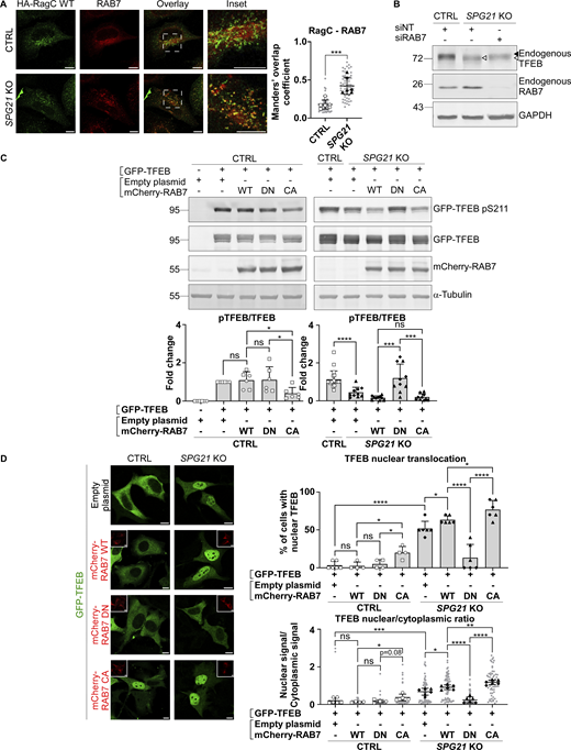 Increased RAB7 GTP/GDP ratio in SPG21 KO HeLa cells impairs TFEB phosphorylation by mTOR. (A) Colocalization analysis between endogenously expressed RAB7 and transfected HA-RagC WT in CTRL and SPG21 KO HeLa cells. Scale bar = 10 µm. The graphs show Mean Manders’ coefficients ± SD. n = 6 (three independent experiments, including two CTRL and two KO clones). 10 cells were analyzed per clone in each experiment (light gray). The averaged values are shown as follows: open circles: CTRL1; open squares: CTRL2; black triangles: KO1; black diamonds: KO2. Two-tailed unpaired t test. ***P < 0.001. (B) Western blotting detection of endogenously expressed TFEB in CTRL and SPG21 KO cells transfected for 48 h with siRNAs targeting RAB7. Non-targeting siRNAs (siNT) were used as controls. One representative set of n = 4 independent experiments is shown. The black arrowhead indicates the higher MW forms of TFEB (pTFEB). The white arrowhead indicates lower MW forms of TFEB (non-phosphorylated). (C) Western blotting analysis of pTFEB/TFEB ratio 48 h after transfection of SPG21 KO HeLa cells (right panel) or control cells (left panel) with GFP-TFEB and either WT, DN, or CA mCherry-RAB7. α-Tubulin and RAB7 chimeric proteins were detected as controls. Right panel: n = 6 (three independent experiments, including two CTRL clones); left panel: n = 10 for the KO cells (five independent experiments, including two different KO clones) and n = 20 for the CTRL cells (each of the 10 blots contained the two CTRL clones co-transfected with GFP-TFEB and an empty plasmid. One of them is shown in the figure). Mean fold change ± SD. Two-tailed unpaired t test. ns, nonsignificant; *P < 0.05; ***P < 0.001; ****P < 0.0001. (D) Investigation of GFP-TFEB localization by confocal microscopy in CTRL and SPG21 KO HeLa cells after transfection with the same constructs. Scale bar = 10 µm. The graphs show the quantification of the percentage of cells with predominant nuclear localization for TFEB (upper graph) or the TFEB nuclear/cytoplasmic signal ratio (lower graph). Mean ± SD. For the control conditions transfected with RAB7 constructs, n = 4 (two independent experiments including two different CTRL clones). For the KO conditions, n = 6 (three independent experiments, including two different KO clones). 10 cells were analyzed per clone, as described in A. Two-tailed unpaired t test. ns, nonsignificant; *P < 0.05; **P < 0.01; ***P < 0.01; ****P < 0.0001. Source data are available for this figure: SourceData F5. Refer to the image caption for details.