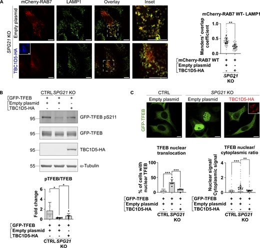Removal of RAB7 from lysosomal membranes rescues TFEB phosphorylation level and localization. (A) Colocalization analysis between mCherry-RAB7 WT and LAMP1 (green) in SPG21 KO HeLa cells 48 h after transfection with an empty plasmid or TBC1D5-HA (blue). Scale bar = 10 µm. The graphs show the quantifications (Manders’ coefficient) of three independent experiments with two different KO clones (n = 6). 10 cells were analyzed per clone in each experiment (shown in light gray). The average values for each clone are shown as follows: black triangles: KO1; black diamonds: KO2. Mean ± SD. Two-tailed unpaired t test. **P < 0.01. (B) Western blotting detection of the pTFEB/TFEB ratio in CTRL and SPG21 KO HeLa cells 48 h after the co-transfection of GFP-TFEB with an empty plasmid or a TBC1D5-HA construct (detected with an anti-HA antibody). The graph shows mean fold changes in pTFEB/TFEB ratio ± SD. n = 8 (four independent experiments with two CTRL and two KO clones). Two-tailed unpaired t test. *P < 0.05. (C) Analysis of GFP-TFEB localization by confocal microscopy in CTRL and SPG21 KO HeLa cells 72 h after co-transfection with an empty plasmid or a TBC1D5-HA (red) construct. Scale bar = 10 µm. The graphs show the percentage of cells with predominant nuclear TFEB (left graph) or the TFEB nuclear/cytoplasmic signal ratio (right graph). n = 6 (three independent experiments including two CTRL and two KO clones). 10 cells were analyzed per clone in each experiment as described in A. Open circles: CTRL1; open squares: CTRL2; black triangles: KO1; black diamonds: KO2. Mean ± SD. Two-tailed unpaired t test. **P < 0.01; ***P < 0.001. Source data are available for this figure: SourceData F6.