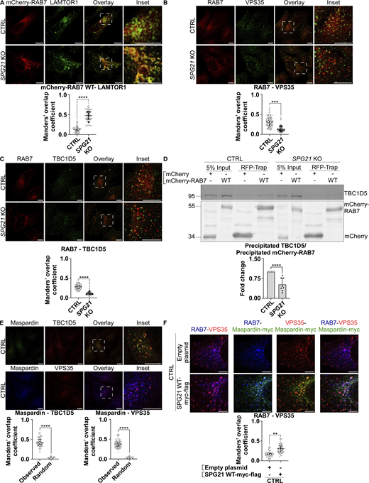 Maspardin deficiency causes delocalization of RAB7 molecules from late endosomes to lysosomes. (A–C) Colocalization analyses between mCherry-RAB7 WT and endogenous LAMTOR1 (green) (A), endogenous RAB7 (red) and VPS35 (green) (B), and endogenous RAB7 (red) and TBC1D5 (green) (C) in CTRL and SPG21 KO HeLa cells. Scale bar = 10 µm. The graphs show mean Manders’ coefficients ± SD. For RAB7-LAMTOR1 and RAB7-TBC1D5 colocalization analyses, n = 6 (three independent experiments with two CTRL and two KO clones); for RAB7-VPS35 analyses, n = 8 (four independent experiments with two CTRL and two KO clones). 10 cells were analyzed per clone in each experiment (shown in light gray). Means of these values for each clone are indicated as follows: open circles: CTRL1; open squares: CTRL2; black triangles: KO1; black diamonds: KO2. Two-tailed unpaired t test. ***P < 0.001; ****P < 0.0001. (D) Expression of WT mCherry RAB7 or mCherry alone in CTRL and SPG21 KO cells followed by their precipitation using RFP-trap beads. The presence of endogenous TBC1D5 proteins among the coprecipitated proteins was assessed by western blotting. n = 8 (four independent experiments, each including 2 CTRL and 2 KO clones). The graph shows mean fold changes ± SD of precipitated TBC1D5 signals normalized to the amount of precipitated bait proteins. Two-tailed unpaired t test. ****P < 0.0001. (E) Colocalization analysis between endogenous maspardin (green) and TBC1D5 (red) or between endogenous maspardin (blue) and VPS35 (red) in CTRL cells. The random overlap between signals was assessed as a negative control by rotating one of the images by 90°. Scale bar = 10 µm. Mean Manders’ coefficient ± SD. n = 6 (three independent experiments including two CTRL clones). 10 cells analyzed per biological replicate, as described above. Two-tailed unpaired t test. ****P < 0.0001. (F) Analysis of endogenous RAB7 distribution (blue) relative to endogenous VPS35 (red) 48 h after transfection of SPG21-myc-flag (green) or a mock construct in control cells (micrographies of individual channels are provided in Fig. S3 F). Scale bar = 5 µm. Mean Manders’ coefficient ± SD. n = 5 independent experiments. 10 cells analyzed per control clone (shown in light gray). The means for each CTRL clone are indicated with different white symbols. Two-tailed unpaired t test. **P < 0.01. RFP, red fluorescent protein. Source data are available for this figure: SourceData F7. Refer to the image caption for details.