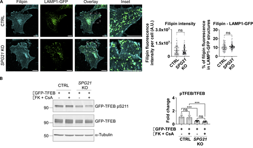 Calcineurin hyperactivation is not responsible for the decreased pTFEB/TFEB ratio in SPG21 KO HeLa cells. (A) Cholesterol staining (filipin) in CTRL and SPG21 KO HeLa cells 48 h after transfection with a LAMP1-GFP plasmid. Graphs show quantifications of filipin fluorescence intensity per cell (left graph) and the relative fluorescence intensity of filipin in LAMP1-GFP–positive structures (right graph). n = 8 (four independent experiments including two CTRL and two KO clones). 10 cells were analyzed per clone in each experiment. These values are shown in light gray. Their averages are shown as follows: open circles: CTRL1; open squares: CTRL2; black triangles: KO1; black diamonds: KO2. Mean ± SD. Two-tailed unpaired t test. ns, nonsignificant, A.U., arbitrary unit. (B) CTRL and SPG21 KO HeLa cells were transfected with GFP-TFEB for 24 h and treated during the last 3 h with 5 µM of FK506 (FK) and 10 µM of cyclosporin A (CsA) or with DMSO (vehicle). pTFEB/TFEB ratio was then analyzed by western blotting. α-Tubulin was used as a loading control. n = 6 (three independent experiments including two CTRL and two KO clones). Mean ± SD. Two-tailed unpaired t test. ns, nonsignificant; ***P < 0.001. Source data are available for this figure: SourceData FS1. Refer to the image caption for details.