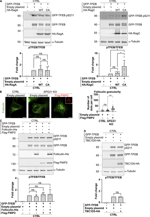 pTFEB/TEFB ratios in control cells after transfection of RagA, RagC, folliculin/FNIP, or TBC1D5 constructs, and analysis of the localization of endogenous folliculin when Flag-FNIP2 is overexpressed. (A, C and D) Western blotting analysis of pTFEB/TFEB ratio in CTRL HeLa cells 24 h (RagA/RagC) or 48 h (folliculin/FNIP; TBC1D5) after transfection of an empty plasmid or GFP-TFEB with either an empty plasmid, HA-RagA (WT or CA), HA-RagC (WT or CA), FLCN-His, and/or Flag-FNIP or TBC1D5-HA constructs. α-Tubulin was used as a loading control. The graphs show the mean fold change in pTFEB/TFEB ratio ± SD. For RagA and RagC overexpression experiments, n = 6 (three independent experiments with two different CTRL clones (open circles: CTRL1; open squares: CTRL2); for folliculin/FNIP and TBC1D5 overexpression experiments, n = 4 (two independent experiments with two different CTRL clones). Two-tailed unpaired t test. ns, nonsignificant; *P < 0.05. (B) Analysis of endogenous folliculin (green) distribution by confocal microscopy in CTRL and SPG21 KO HeLa 48 h after the overexpression of a Flag-FNIP2 plasmid (red) or an empty plasmid. Scale bar = 10 µm. The graph shows the quantifications of folliculin granularity. n = 6 (three independent experiments, including two CTRL and two KO clones). 10 cells were analyzed per clone in each experiment. These values are shown in light gray. Their averages are shown as follows: open circles: CTRL1; open squares: CTRL2; black triangles: KO1; black diamonds: KO2. Mean ± SD. Two-tailed unpaired t test. ns, nonsignificant. **P < 0.01. Source data are available for this figure: SourceData FS2. Refer to the image caption for details.