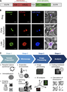 Establishing a dynamic imaging platform to follow subcellular events throughout parasite’s 48-h life cycle. (A) Schematic representation of the genetic reporter. mRuby was fused to histone H2B for nuclear labeling, while mNeon was linked to an apicoplast-specific TP for organelle targeting. The T2A sequence facilitates ribosomal skipping during translation, enabling the expression of two separate proteins driven by a single promoter. (B) Representative fluorescence live microscopy images of the H2B-mRuby/TP-mNeon transgenic parasite line at different stages of its life cycle. Images were captured as Z-stacks (total 21 slices of 0.5 μm each) at 100× and are displayed as maximum intensity projection. Apicoplast is green, and nucleus is distinctly labeled in red. DNA staining with SiR-DNA (blue) confirms nuclear localization of the mRuby signal. The scale bar is 2.5 μm. (C) Workflow for long-term live imaging and biogenesis analysis, highlighting sample preparation and microscopy optimization, followed by automated image processing and analysis.