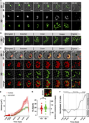Dynamic imaging reveals morphological details, kinetics, physical measurements, and a tight synchrony in the co-development of nuclei and apicoplast. (A) Representative images from sequential capturing of apicoplast biogenesis of P. falciparum. Images were captured as Z-stacks (total 21 slices of 0.5 μm each) at 100× for 20 h with 30-min intervals using spinning disk confocal microscope. The images are displayed as maximum intensity projections (2D) or volume reconstructed for 3D visualization using NIS image analysis software. The scale bar is 2.5 μm. (B) 3D reconstructed images of H2B-mRuby/TP-mNeon parasites using Imaris image analysis software show detailed apicoplast morphologies (green) along with nucleus location (red dots) during life cycle. Scale bars, 2.5 μm. (C) Representative long-term fluorescence live-cell microscopy images show detailed apicoplast (green) and nucleus (red) morphologies and conformations during different stages of parasite’s life cycle in 2D (as maximum intensity projections of Z-stack images) and 3D (volume visualizations). 2D cell appears also at Fig. 6 B as untreated control. Images were captured using a spinning disk confocal microscope at 100× as Z-stacks (total 21 slices of 0.5 μm each) with 15 min time intervals for 20 h. 2D scale bars, 2.5 μm. 3D grid, 2 × 2 μm. (D) Quantification of median organellar volume over time was obtained as described in Materials and methods for 151 parasites (n > 20 for each time point), from 4 independent experiments. Error bars are 95% CI. (E) Final number of organelles (“objects”) per parasite was obtained as described in Materials and methods for n > 40 parasites from 4 independent experiments. The difference between nuclei and apicoplast mean number of objects (17 ± 5.8 (nuc) and 19 ±5.6 (api), (api - nuc) = 2 ± 3.8) is not significant. Unpaired t test with Welch’s correction, P = 0.1, ns. Inset taken from 2C, grid, 2 × 2 μm. (F) Quantification of median organelle SA:V ratio vs. time was obtained as described in Materials and methods for n > 20 parasites for each time point, from four independent experiments. SA:V ratio vs. time is a mathematical representation of the extensive branching and shapeshifting of the apicoplast, particularly expanding at the last 6 h of the cell cycle.