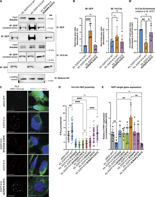 SCRAPS motif and the stutter cysteine are required to interconvert YAP1 interaction between K14 and K15. (A) Representative co-immunoprecipitations of HeLa cells transfected with untagged K5 and EGFP-tagged WT K14, K15, and mutant K15. Pull-down of endogenous 14-3-3σ is depicted. (B) Differential levels of WT K15, relative to WT K14 or mutant K15, were observed in the soluble fraction. Transfection of keratin(s) did not affect endogenous 14-3-3σ levels. WB intensity was normalized to a loading control (histone H3). Dots represent three independent replicates, displaying mean and standard error. Comparisons were made using one-way ANOVA, ****P < 0.0001, ns = not significant. (B′) Endogenous 14-3-3σ pulls down more efficiently with WT K14 and mutagenized K15, as compared to WT K15. Equation to calculate 14-3-3σ pull-down efficiency is described in Materials and methods. Dots represent three independent replicates. Comparisons were made using one-way ANOVA, **P = 0.0055, *P = 0.0237, ns = not significant. (C) Representative micrographs of YAP1-14-3-3σ PLA performed on transfected HeLa cells. Cells were transfected with untagged K5 and EGFP-tagged WT and mutant K14 or K15. Merge panels show PLA punctae (red), EGFP-tagged keratin autofluorescence (green), and DAPI counterstain (blue). Scale bar = 10 µm. (D) Scatter plots representing YAP1-14-3-3σ PLA punctae counted per cell in three pooled independent replicates, displaying mean and standard deviation. Dots represent a sc. Comparisons were made using Mann–Whitney tests. ****P < 0.0001, **P = 0.0033, ns = not significant. (E) Transcription of a YAP1 target gene, CYR61, as measured via RT-qPCR in HeLa cells transfected with untagged K5 and WT and mutant K14 or K15. Dots represent six independent replicates. Comparisons were made using Mann–Whitney tests, **P = 0.0033, ns = not significant. Source data are available for this figure: SourceData F6.