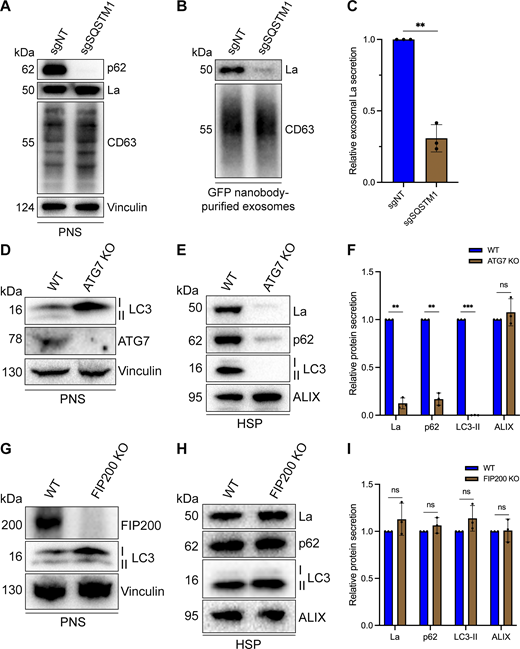 p62 and ATG7 are required for La secretion. (A) Immunoblot analysis of MDA-MB-231 cells expressing HA-CD63-mEGFPECL1, ZIM3-KRAB-dCas9, and either a nontargeting (sgNT) or p62/SQSTM1-targeting (sgSQSTM1) sgRNA. (B) Immunoblot analysis of exosomes immunoisolated from the conditioned medium of MDA-MB-231 cells expressing HA-CD63-mEGFPECL1, ZIM3-KRAB-dCas9, and either sgNT or sgSQSTM1. (C) Quantification of exosomal La secretion from sgNT and sgSQSTM1 cells. Statistical significance was performed using an unpaired two-tailed t test (n = 3; **P < 0.01). (D) Immunoblot analysis of HEK293T WT and ATG7 KO cells. (E) Immunoblot analysis of HSP fractions isolated from the conditioned medium of HEK293T WT and ATG7 KO cells. (F) Quantification of La, p62, LC3-II, and ALIX secretion from WT and ATG7 KO cells. Statistical significance was performed using unpaired two-tailed t tests (n = 3; **P < 0.01; ***P < 0.001; and ns, not significant). (G) Immunoblot analysis of HEK293T WT and FIP200 KO cells. (H) Immunoblot analysis of HSP fractions isolated from the conditioned medium of HEK293T WT and FIP200 KO cells. (I) Quantification of La, p62, LC3-II, and ALIX secretion from WT and FIP200 KO cells. Statistical significance was performed using unpaired two-tailed t tests (n = 3; ns, not significant). Source data are available for this figure: SourceData F7.
