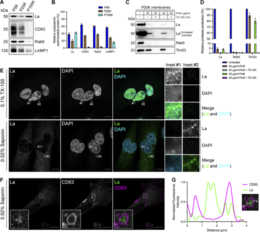 Cytosolic La is captured into the lumen of late endosomes. (A) Mechanically ruptured MDA-MB-231 cells were subjected to differential centrifugation. Immunoblot analysis of the 5,000 × g pellet (P5K), 20,000 × g pellet (P20K), and 100,000 × g pellet (P100K) was conducted to assess the presence of the indicated proteins. (B) Quantification of the indicated proteins within the membrane pellet fractions from Fig. 1 A (n = 3). (C) Immunoblot analysis of proteinase K protection assays conducted on a P20K membrane fraction to assess whether the indicated proteins were sequestered within the lumen of a detergent-sensitive compartment. (D) Quantification of the proteinase K protection experiments from Fig. 1 C (n = 3). (E) Airyscan microscopy of endogenous La with DAPI counterstain from MDA-MB-231 WT cells permeabilized with either 0.1% TX-100 or 0.02% saponin. Green: La; cyan: DAPI. Scale bar: 10 µm. (F) Airyscan microscopy of endogenous La and CD63 from MDA-MB-231 WT cells permeabilized with 0.02% saponin. Green: La; magenta: CD63. Scale bar: 10 µm. (G) Quantification of La and CD63 fluorescence intensity from point A to point B in the indicated inset of Fig. 1F. Source data are available for this figure: SourceData F1.