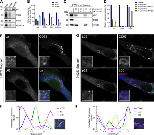 p62 is captured together with La into the lumen of late endosomes. (A) Mechanically ruptured MDA-MB-231 cells were subjected to differential centrifugation. Immunoblot analysis of the 5,000 × g pellet (P5K), 20,000 × g pellet (P20K), and 100,000 × g pellet (P100K) was conducted to evaluate the presence of the indicated proteins. (B) Quantification of the indicated proteins within the membrane pellet fractions from Fig. 3 A (n = 3). (C) Immunoblot analysis of proteinase K protection assays on a P20K membrane fraction to evaluate whether the indicated proteins were sequestered within the lumen of a detergent-sensitive compartment. (D) Quantification of the proteinase K protection experiments from Fig. 3 C (n = 3). (E) Airyscan microscopy of endogenous La, CD63, and p62 from MDA-MB-231 cells permeabilized with 0.02% saponin. Green: La; magenta: CD63; blue: p62. Scale bar: 10 µm. (F) Quantification of La, CD63, and p62 fluorescence intensities from point A to point B of the indicated inset of Fig. 3 E. (G) Airyscan microscopy of endogenous LC3, CD63, and p62 from MDA-MB-231 cells permeabilized with 0.02% saponin. Green: LC3; magenta: CD63; blue: p62. Scale bar: 10 µm. (H) Quantification of LC3, CD63, and p62 fluorescence intensities from point A to point B of the indicated inset of Fig. 3 G. Source data are available for this figure: SourceData F3. Refer to the image caption for details.