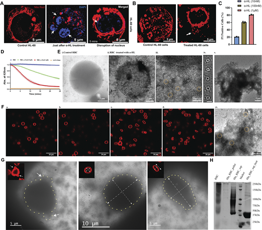 Effect on HL-60 cells and RBCs after α-HL. (A) Intensity of the nucleus (in blue color) staining with DAPI dye (λexcitation= 405 nm, λemission= 480–510 nm) increased for the first couple of minutes, where the three nuclear lobes (white arrowhead) became clearly visible due to the uptake of the dye from the outside medium. After some time (5 min), the intensity of the nucleus started decreasing, and three distinct lobes of the nucleus started disappearing. Nile red intensity (λexcitation= 540 nm, λemission= 565–610 nm) corresponding to the membrane (in red color) started decreasing rapidly just after toxin treatment at a 100 nM toxin concentration. (B) Toxin treatment showed membrane protrusion (in red color) from HL-60 cells at 100 nM toxin concentration. (C) Flow cytometry analysis of 10 nM, 100 nM, and 1 µM toxin-treated HL-60 cells stained with PI. Compared with the untreated cells, the toxin-treated cells started becoming necrotic, as evident by the increase in PI-positive cells. Data are shown as the mean ± SD of triplicate measurements (n = 3 biological triplicates). (D) Concentration-dependent hemolysis of rabbit erythrocytes (10%) was monitored after adding different concentrations of purified monomeric α-HL at 37°C. (E) Different stages of RBC damage were captured using NS-TEM after adding the toxin: i. untreated control RBC; ii. damaged membrane of RBCs after α-HL addition; iii. zoomed view of the membrane area showed circular-shaped particles (yellow encircled); iv. 2D class averages of the particles confirmed the circular shape of the toxin (scale bar: 10 nm); v. lysed cell after completion of hemolysis; and vi. a zoomed view of the lysed-membrane area showed circular-shaped particles (yellow encircled). (F) Toxin-incubated RBC samples were imaged under a confocal microscope at different time points: (a) just after toxin addition; (b) starting point of membrane damage 2 mins post-toxin addition; (c) lysis initiation state after 5 mins; and (d) mostly lysed cells after 10 min. The cell membranes (in red color) were stained using Nile red dye (λexcitation= 540 nm, λemission= 565–610 nm). (G) Correlation of toxin-mediated damage in RBCs using high-resolution cryo-EM imaging with the confocal data (shown in top left). The protruded portions’ size from cells under confocal and cryo-EM in the left side panel was around 1 µm. The ratio of width to length of cells under confocal and cryo-EM was 1.2 in the middle panel. The ratio of width to length of cells under confocal and cryo-EM was 0.74 in the right side panel. (H) SDS-PAGE of RBC treated with α-HL (from left side to right side, control RBC, RBC pellet after toxin incubation, supernatant from the toxin-incubated sample, protein marker, supernatant sample after heating). RBCs, red blood cells. Source data are available for this figure: SourceData F1.