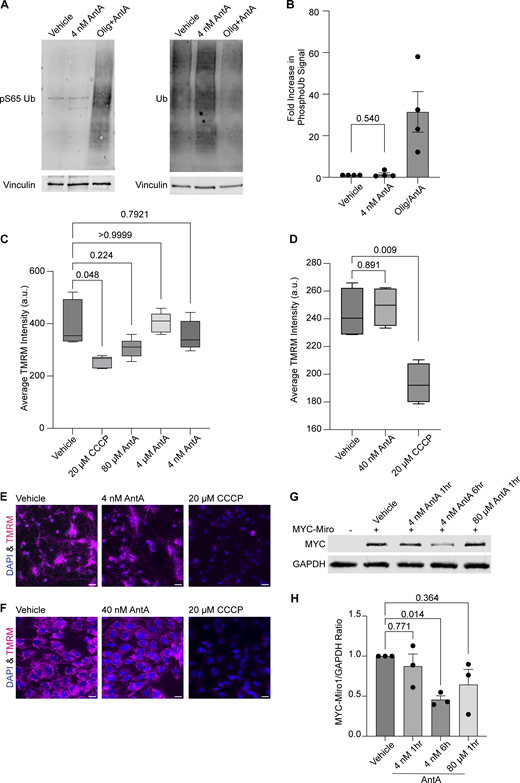 4 nM AntA does not arrest mitochondria by the PINK1/Parkin pathway. (A) Western blot of cortical neurons treated for 5 h with vehicle or 10 µM AntA and 1 µM oligomycin or 1 h of 4 nM AntA. Blots were probed for phospho-S65 ubiquitin or total ubiquitin. Anti-vinculin is shown as a loading control. (B) Quantification of phospho-S65 ubiquitin levels as in A; n = 4 biological repeats. (C) Quantification of mitochondrial membrane potential in hippocampal neurons stained with the reporter dye TMRM. Neurons were pretreated for 1 h with the indicated concentration of ETC inhibitor, after which TMRM and Hoechst were added. Cells were imaged live with both dyes and inhibitor present. Five cell fields were imaged from four independent biological repeats. TMRM intensity is normalized to cell count. (D) Quantification of TMRM intensity in fibroblasts grown in galactose media. Cells were pretreated for 1 h with the indicated concentration of ETC inhibitor, after which TMRM and Hoechst were added. Cells were imaged live with both dyes and indicated ETC inhibitors. 15–20 cell fields were imaged from 4 independent biological repeats. (E) Representative images from neurons treated with vehicle, 4 nM AntA, or 20 µM CCCP, as in C. (F) Representative images from fibroblasts treated with vehicle, 40 nM AntA, or 20 µM CCCP as in D. (G) Western blot of cortical neurons overexpressing MYC-Miro1 from the hSYN1 promoter. Cells were treated with AntA at the indicated concentrations and for the indicated times. Blots were probed with anti-MYC and with anti-GAPDH as a loading control. (H) Quantification of western blots as in G. n = lysates from three independent biological replicates. The P value for B was calculated by a two-tailed, unpaired t test with Welch’s correction. A one-way Welch ANOVA was performed with Dunnett’s T3 multiple comparison correction for C and D. P values were calculated by performing a blocked one-way ANOVA with Dunnett’s T3 multiple comparison correction for H. Scale bars = 20 μm. Source data are available for this figure: SourceData FS2.