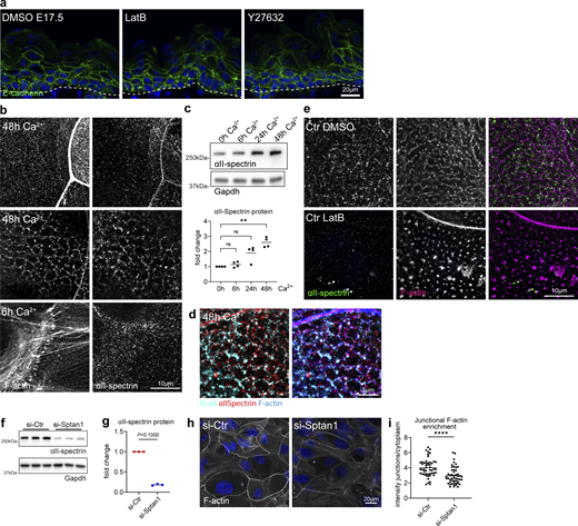 Cortical F-actin and spectrin organization are mutually dependent. (a) Sagittal views of dorsal skin sections from E17.5 wild-type embryos treated with DMSO, latrunculin, and Y27632 immunolabeled for E-cadherin. Nuclei were stained with DAPI; dotted lines indicate the dermal-epidermal border. NS, not significant. (b) Immunofluorescence analysis for αII-spectrin and F-actin after 6 or 48 h in high Ca2+ at cell–cell interfaces and apical surface. Single channels corresponding to Fig. 3 g. (c) Western blot analysis and quantification for αII-spectrin protein levels after Ca2+ switch for the time point indicated. Normalized to GAPDH and to 0 h Ca2+ time point. Dots represent biological replicates from n = 4 independent primary keratinocyte isolates. **P = 0.003 with Kruskal–Wallis, Dunn’s multiple comparison test. (d) Immunofluorescence analysis for E-cadherin, αII-spectrin, and F-actin after 48 h in high Ca2+ at cell–cell interfaces. (e) Immunofluorescence analysis for αII-spectrin and F-actin after 48 h in high Ca2+ at cell–cell interfaces with and without latrunculin B treatment (1 h, 0.1 µM). Single channels corresponding to Fig. 3 i. (f) Western blot analysis for αII-spectrin protein levels upon siRNA (siPOOLs)-mediated knockdown 96 h after transfection (72 h Ca2+). (g) Western blot quantification for αII-spectrin as shown in f, normalized to GAPDH. Dots represent biological replicates, n = 3 with Mann–Whitney. Representative example of n = 6 independent primary keratinocyte isolates. (h) Immunofluorescence analysis of F-actin organization at apical junction rings after 48 h in high Ca2+ and siRNA-mediated knockdown of αII-spectrin. (i) Quantification of F-actin intensity at apical junction rings (mean gray value, junctions/cytoplasm) as shown in h. Dots represent pooled values of single cells from n = 3 biological replicates. ****P < 0.0001 with Kolmogorov–Smirnov. Right graph: Mean values from n = 3 biological replicates tested with Mann–Whitney. Source data are available for this figure: SourceData FS3.
