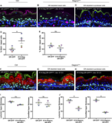 DegronGFPefficiently depletes GR-GFP and reproduces knockout phenotypes. (A–C) Immunofluorescence staining of GFP (green) and EdU (magenta) in E18.5 back skin epidermis of GR-GFP (A), K14-Degron;GR-GFP (B), and K10-Degron;GR-GFP (C) embryos. *: Indicates nonspecific signal in cornified layer. Scale bar: 20 μm. (D) Percentage of Edu-positive cells in K14-Degron;GR-GFPHom vs. GR-GFP control littermates. Each circle represents measurements of a mouse: solid color circles represent mice dox-exposed since E13.5, and circles with a dot represent dox-exposed mice since E16.5 (n = 5 mice per genotype). Lines show the mean ± SEM. *: P = 0.0172, paired two-tailed t tests. (E) Percentage of Edu-positive cells in K10-Degron;GR-GFPHom vs. GR-GFP control littermates. Each circle represents measurements of a dox-exposed mouse since E13.5 (n = 4 mice per genotype). Lines show the mean ± SEM. *: P = 0.0235, paired two-tailed t test. (F–H) Immunofluorescence staining of GFP (green) and loricrin (red) in E18.5 back skin epidermis of GR-GFP (F), K14-Degron;GR-GFP (G), and K10-Degron;GR-GFP (H) embryos. White and pink lines show granular and cornified layer thickness, respectively. Dotted white lines represent the basement membrane. Scale bar: 20 μm. (I) Quantification of loricrin and cornified layer thickness in GR-GFP controls vs. K14-Degron;GR-GFPHom littermates. Each circle represents the average layer thickness of a mouse: solid color circles represent mice dox-exposed since E13.5, and circles with a dot represent dox-exposed mice since E16.5. Lines show the mean ± SEM. Loricrin and cornified thickness measurements were taken perpendicular to the basement membrane (n = 3 mice per genotype, at least 22 measurements per mouse) P = 0.0528 and 0.1206, respectively. ns, nonsignificant; paired two-tailed t tests. (J) Quantification of loricrin and cornified thickness in GR-GFP controls vs. K10-Degron;GR-GFPHom littermates. Each circle represents the average loricrin or cornified thickness of a mouse dox-exposed since E13.5. Lines show the mean ± SEM (n = 3 mice per genotype, at least 30 measurements per mouse) *: P = 0.033 and 0.1206. ns, non-significant; paired two-tailed t tests. Pregnant dams were fed with dox chow from E13.5 to 16.5.