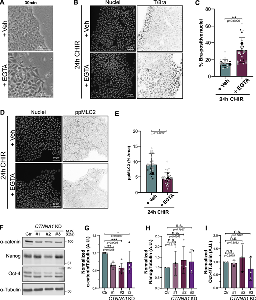 EGTA treatment and validation CTNNA1 KD hiPSCs (related to Fig. 4). (A) Bright-field picture showing the colony morphology following EGTA pretreatment. Colony appears less compact, and individual cell boundaries can be distinguished. Scale bar = 20 μm. (B and C) Representative immunofluorescence of hiPSCs treated as shown in Fig. 4 A and stained for Brachyury. Scale bar = 50 μm (B). Quantification of Brachyury-positive nuclei is shown following EGTA treatment. Mean and SD are displayed. n = 18 (Veh) and n = 20 fields of view across N = 3 independent biological repeats. A two-tailed unpaired t test was performed on biological repeats (C). (D and E) Representative immunofluorescence of hiPSC treated as shown in Fig. 4 A and stained for ppMLC2. Scale bar = 50 μm (D). Quantification of ppMLC2-positive area is shown following EGTA treatment. Mean and SD are displayed. n = 20 (Veh) and n = 25 fields of view across N = 4 independent biological repeats. A two-tailed unpaired t test was performed on biological repeats (E). (F–I) Representative immunoblot of control (Ctr) or CTNNA1 KD hiPSCs, probed for α-catenin, Nanog and Oct-4 (pluripotency), and α-tubulin as loading control. M.W. are displayed on the right side (F). Quantification of α-catenin (G), Nanog (H), and Oct-4 (I) expression was obtained by densitometry across N = 5–6 (α-catenin), N = 4 (Nanog), and N = 3 (Oct-4) independent biological repeats. Mean and SD are displayed. One-way ANOVA with Dunnett’s multiple comparisons posttest was performed. M.W., molecular weights; Veh, vehicle. ***P < 0.001, **P < 0.01, *P < 0.05. Source data are available for this figure: SourceDataFS5. Refer to the image caption for details.