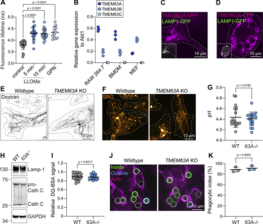 A multi-part image depicts lysosomal membrane tension and TMEM63A expression in macrophages.