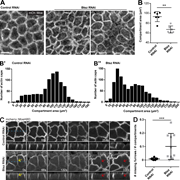 Multiple graphs and microscopic images depict actin cap size and pseudo-cleavage furrow formation in control and Btsz RNAi embryos.