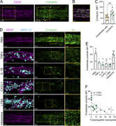 A multi-part image showing cortactin expression in venules during inflammation.