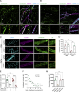 A multi-panel image depicts cortactin degradation in endothelial cells.