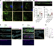 A multi-panel image showing neutrophil interaction with endothelial cells.