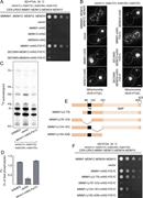A multi-panel figure shows experimental results related to the ERMES complex in yeast.