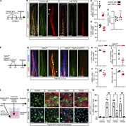 A multi-panel image shows the role of TGF signaling in fibroblast to myofibroblast differentiation and villus smooth muscle cell formation in postnatal villi.
