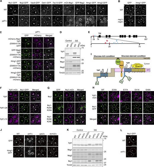 A multi-panel image of yeast cells expressing various proteins after glucose starvation.